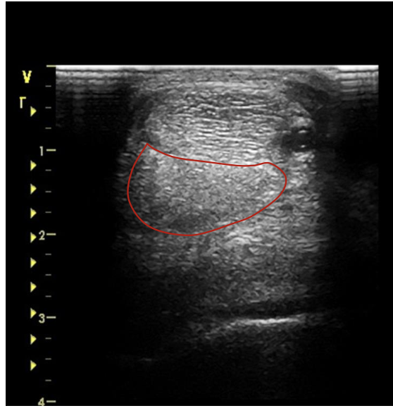 <p>what is the red circling?</p>