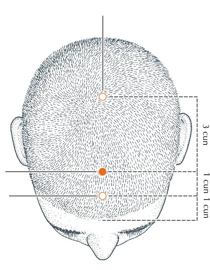 <p>DU-22</p>