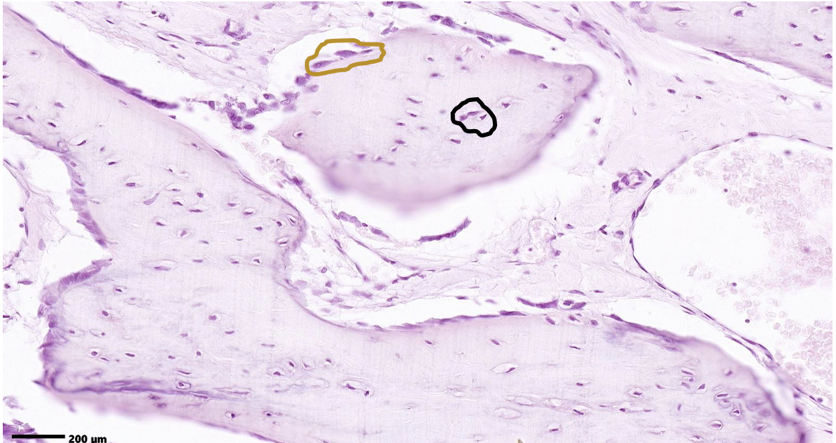 <p>What method of bone formation is occurring here? ID the cells in the black circle. ID the cells in the brown circle.</p>