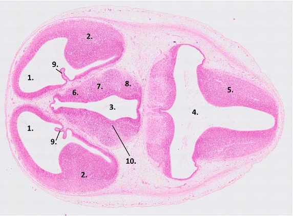 <p><span>Transverse section of a 15-days old rat embryo. The <strong>myelencephalon</strong>, <strong>diencephalon </strong>and <strong>telencephalon </strong>are visible</span></p>
