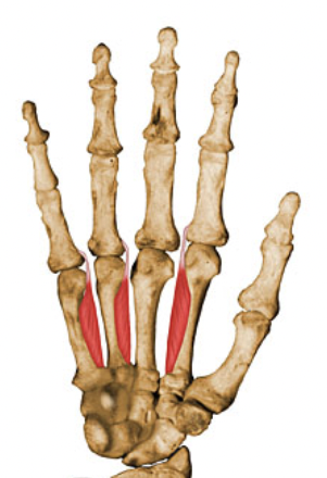 action:

Adduct digits toward axial line and assist lumbricals in flexing metacarpo-phalangeal joints and flex interphalangeal joints.