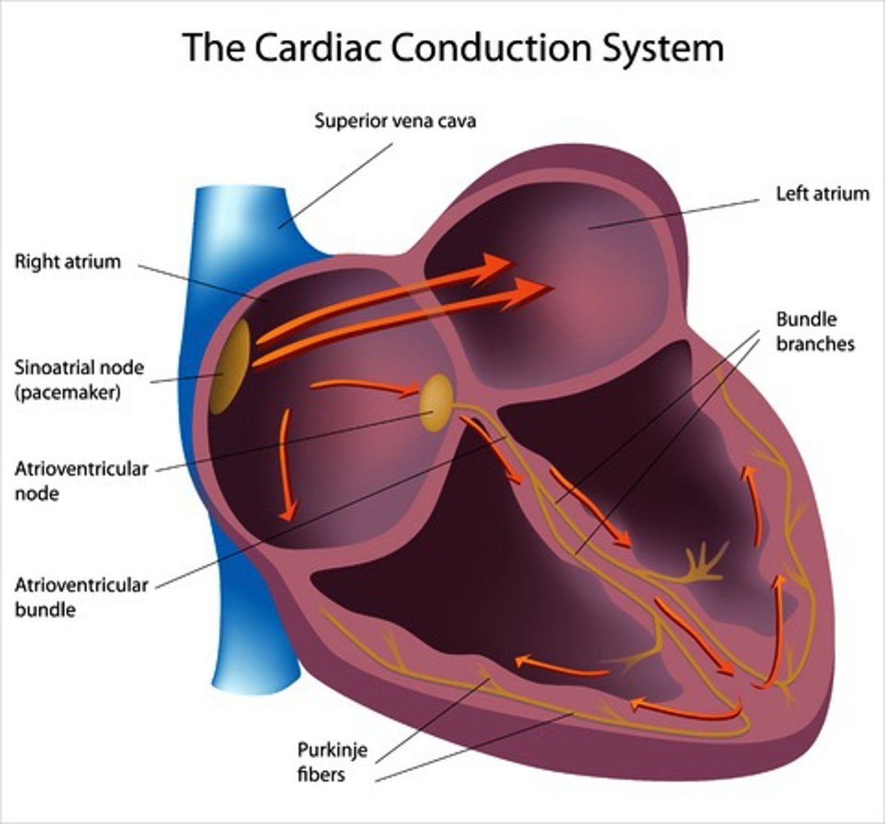 <p>End of the conduction system; sends impulses through the ventricles, causing them to contract</p>
