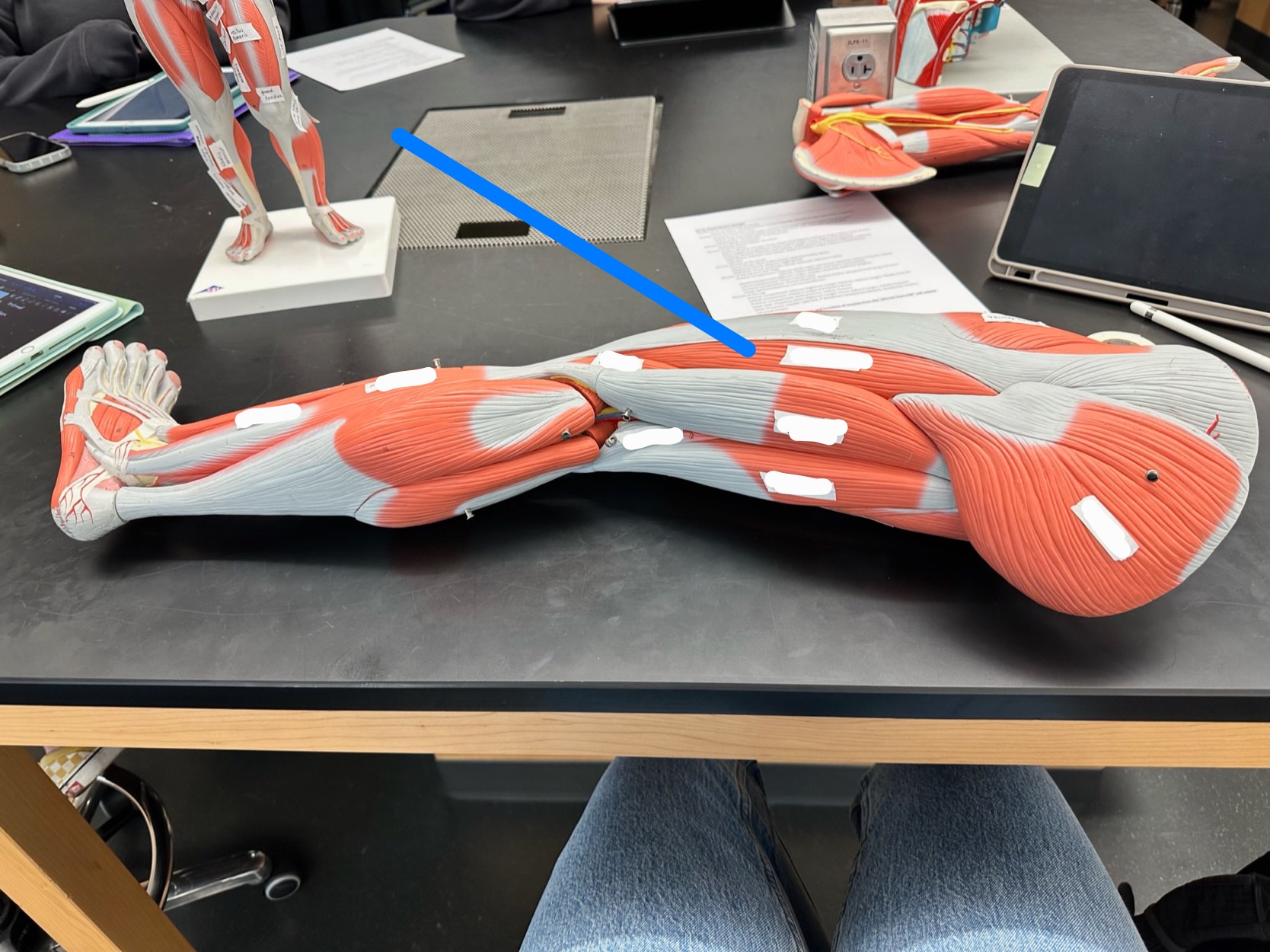<p>ID muscle</p>