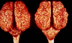 <p>What is wrong with the brain to the left? What is the causative infectious agent of this congenital defect?</p>