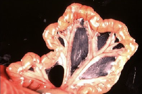 <p>double layer of peritoneum layers fused back to back, provides routes for blood vessels lymphatics, and nerves</p>