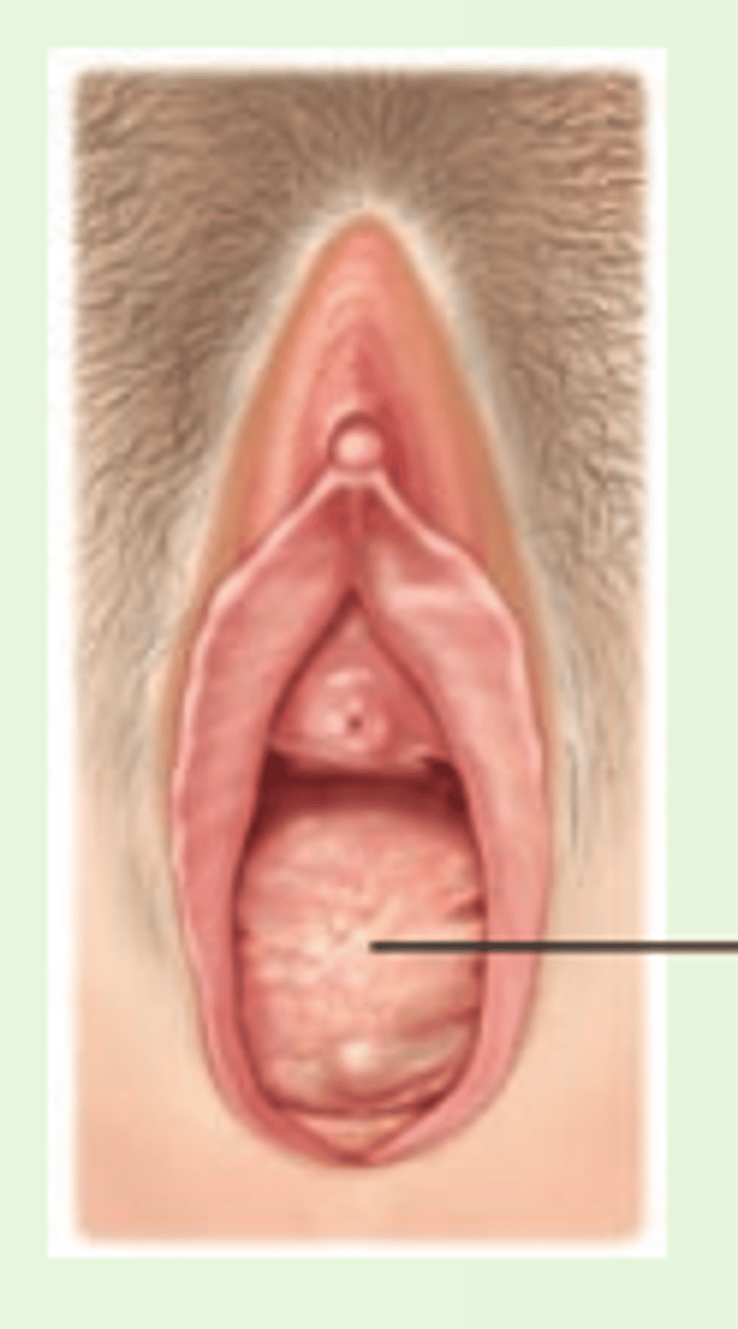 <p>herniation of the rectum into the posterior wall of the vagina</p>