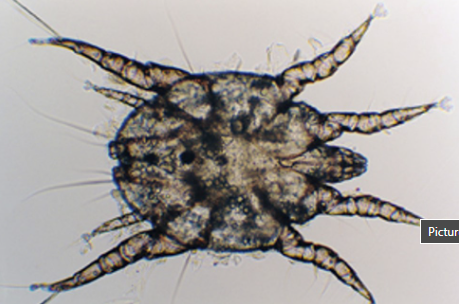 <p><span>This was found in the ear of a kitten.&nbsp; What is it?</span></p>