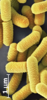 <p>What shape of bacteria is this?</p>
