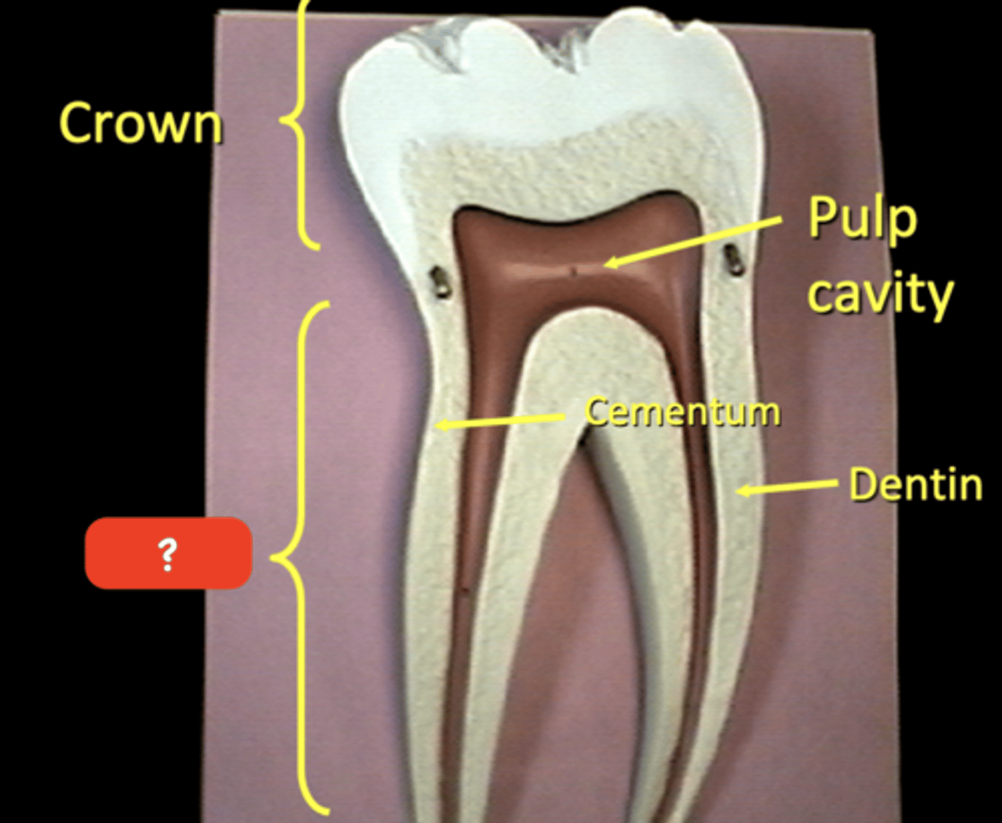 knowt flashcard image