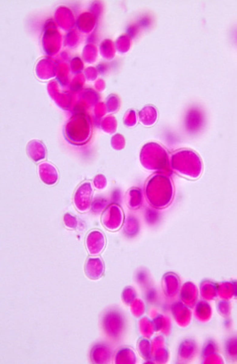 <p>At 37ºC, Blastomyces dermatitidis produces broad-based budding yeast cells with thick walls.</p>