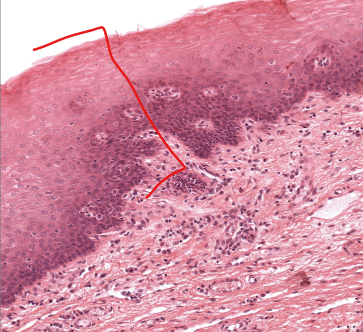 <p>(tissue type)</p>