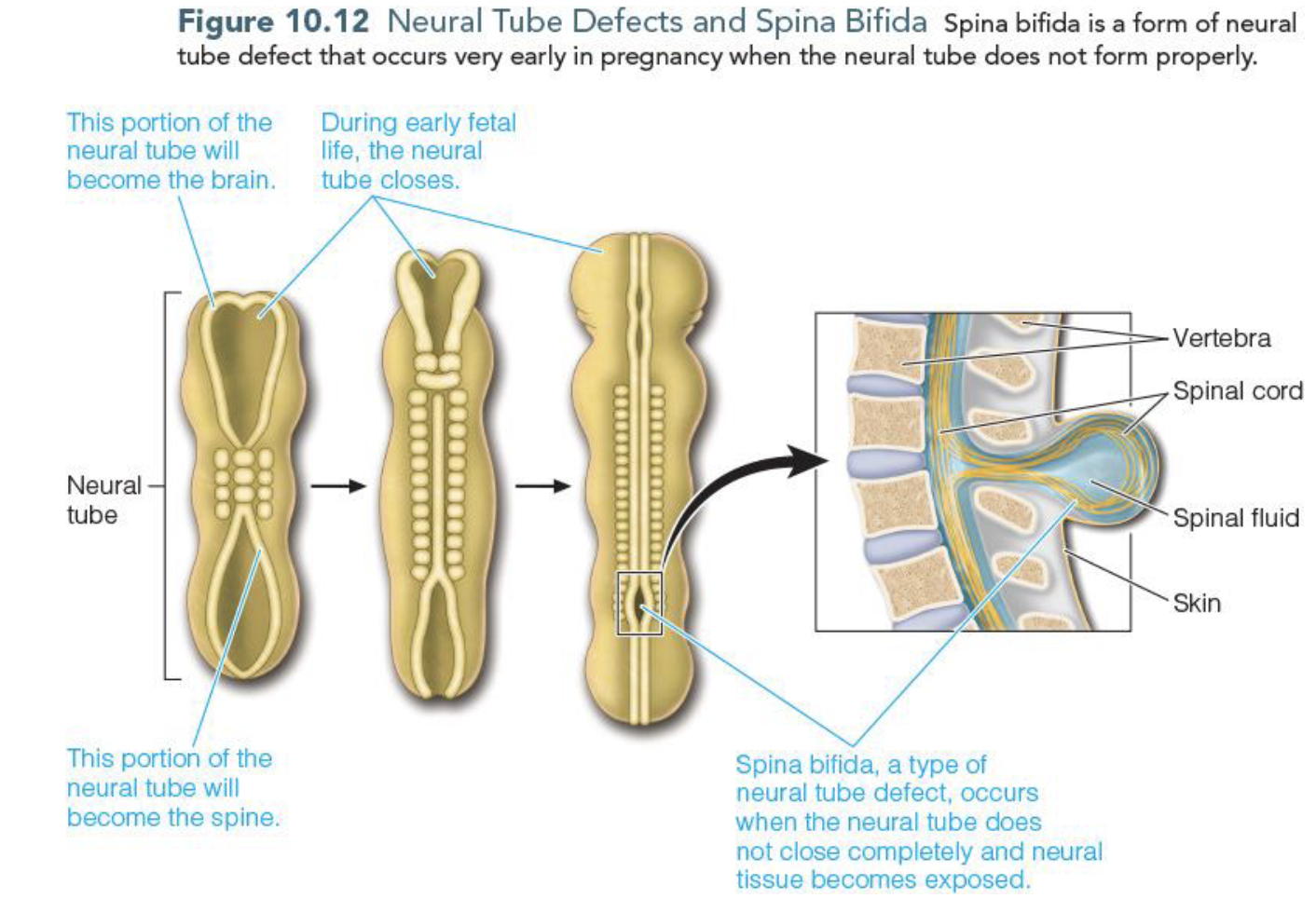 <p>Folate is important in the formation of neural tube and w/o folate neural tube will have improper closing leading to</p><ul><li><p>spina bifida (most common)/birth defect</p></li><li><p>Anencepahly/birth defect & fatal</p></li></ul><p></p>