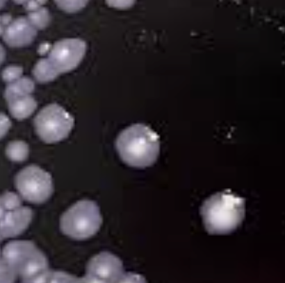 <p>Temp: 35C</p><p>Media: BCYE</p>