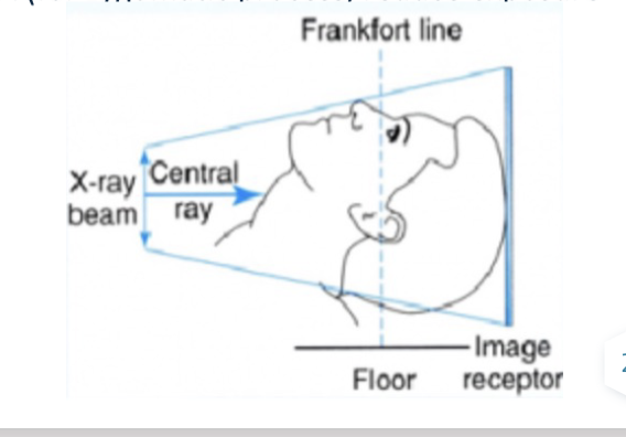 <p>Used to assess potential pathology, trauma, or disease progression to the base of the skull like in foramen ovale, foramen spinosum, and sphenoid sinus. Assessment of facial asymmetry. Determine angulation of condylar heads compared to the cranial base. Detect fractures in zygomatic process.</p>