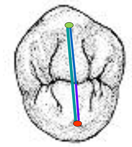 <p>Name the tooth and hi-lighted portions</p>