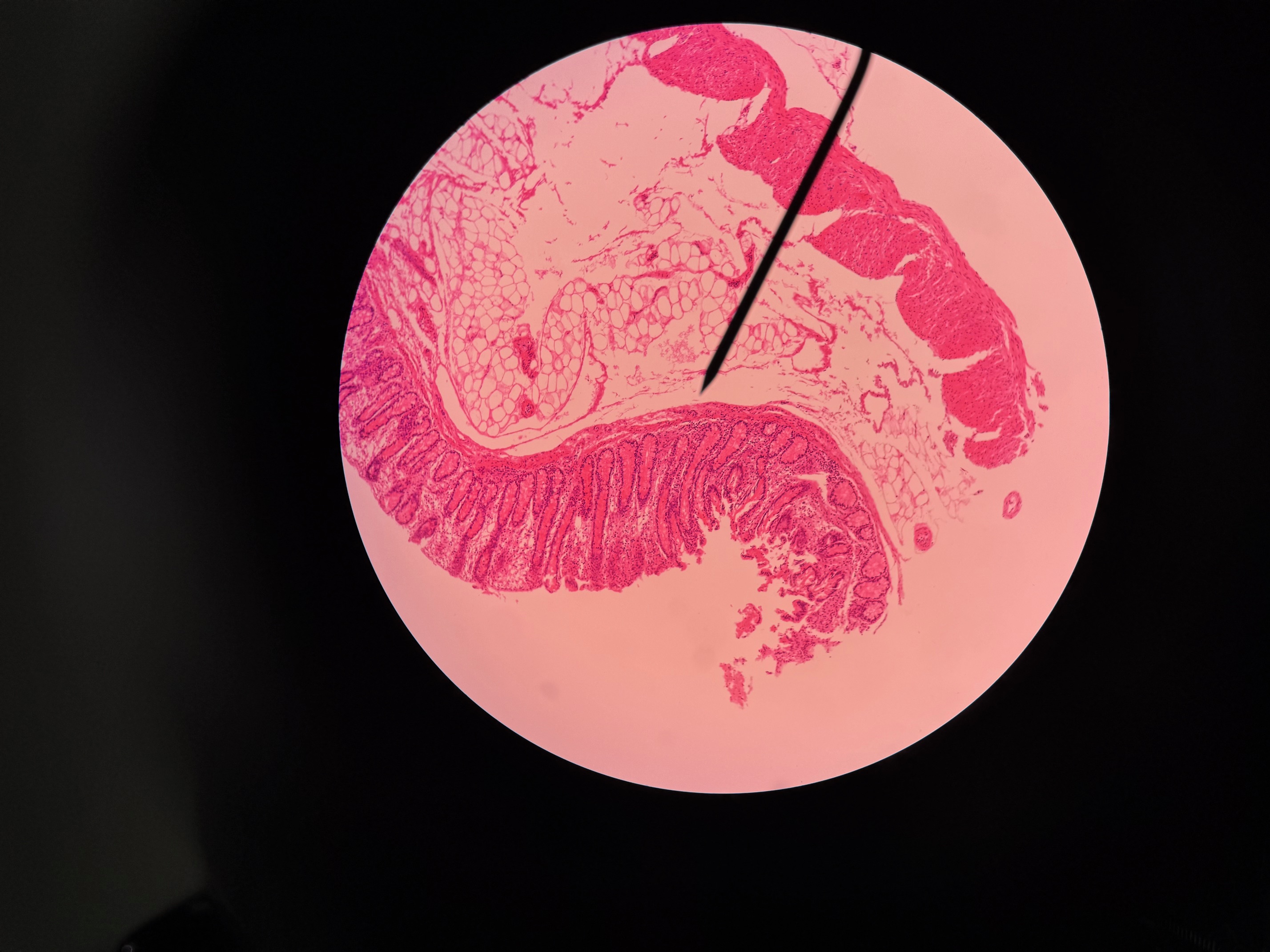 <p>Organ?</p><p>Region?</p>