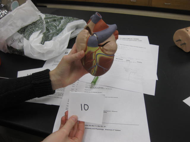 <p>Body Cavities and Body Systems</p><p>Lab Image 1-17</p>