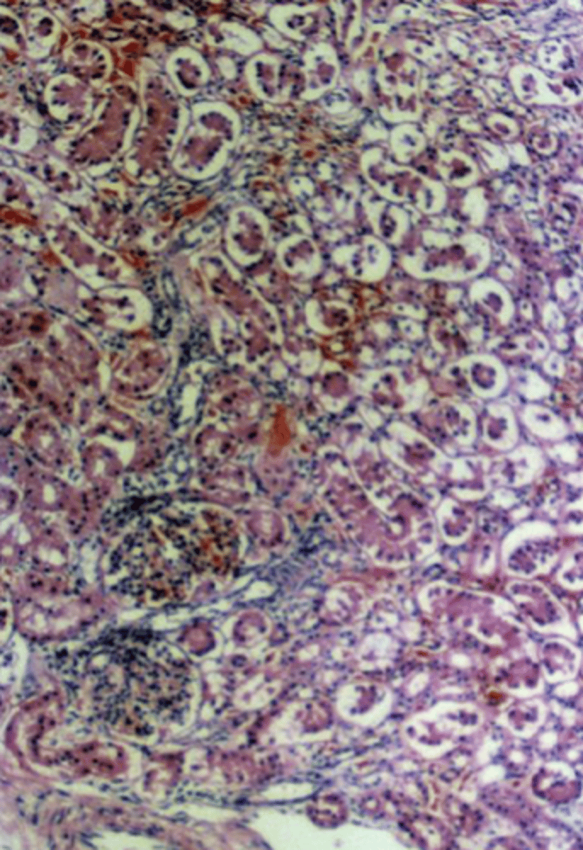 <p>what histological artifact?</p>