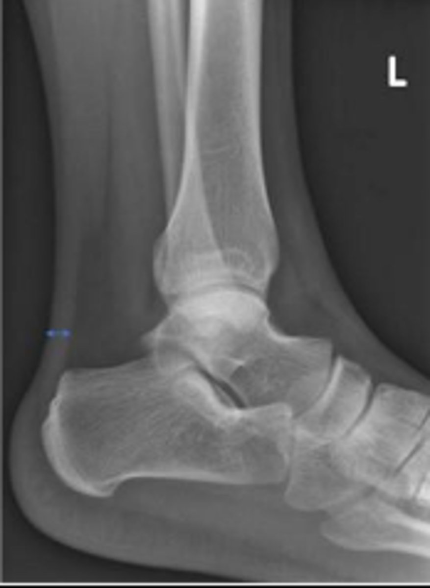 <p>What is the name of the assessment?</p>