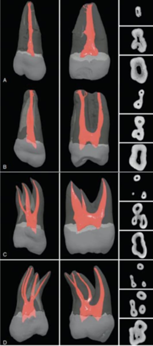 <p>rhomboidal</p>