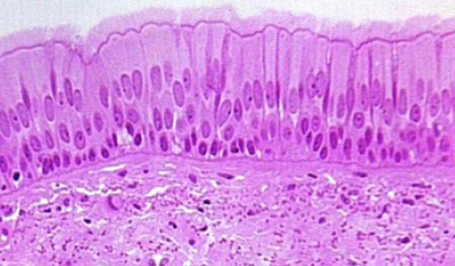 <p>-<strong>multiple layers</strong> with varying cell heights</p><p><strong>-functions</strong> → <strong>secretes mucus</strong> & <strong>traps dust</strong> particles, moving them away from lung</p>