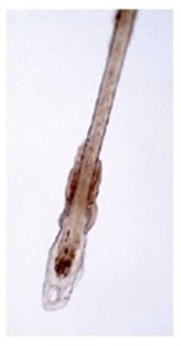 <p>In welke fase van de groei zit dit haar?</p><p>- niet gepigmenteerd, volledig gekeratiniseerd</p><p>- clubvormige bulbus</p><p>- restanten van de haarschede</p>