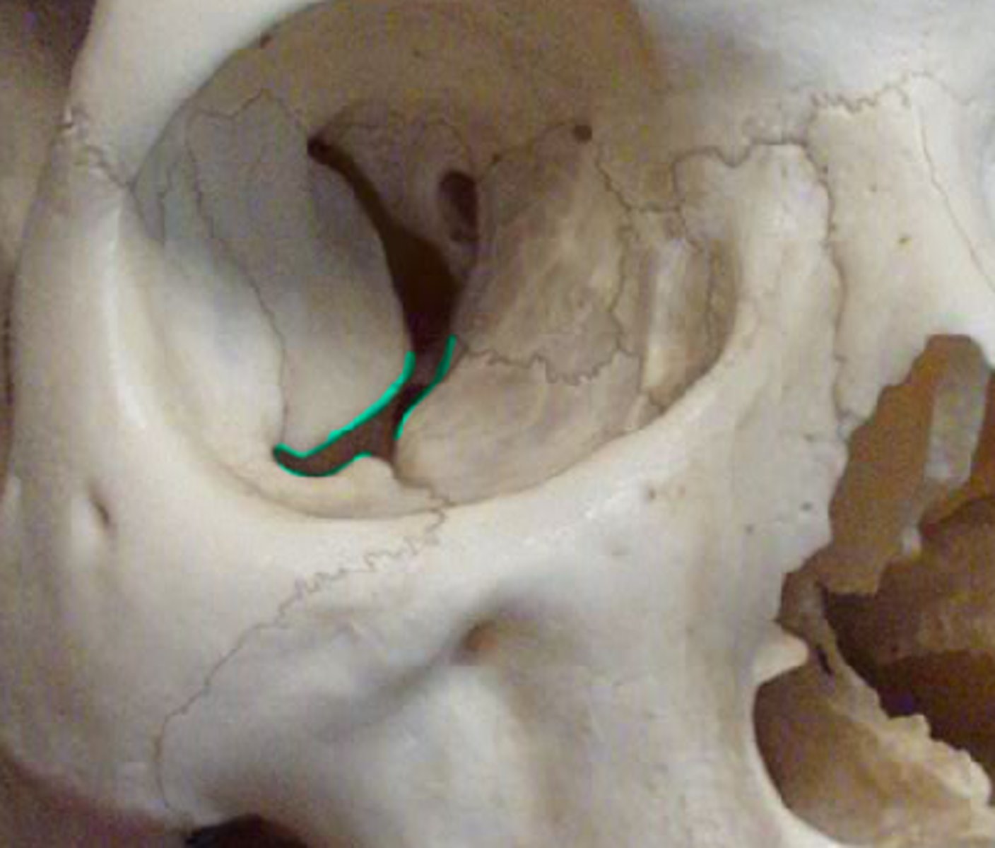 <p>Gap between greater wing of sphenoid, maxilla, and zygomatic bone</p>