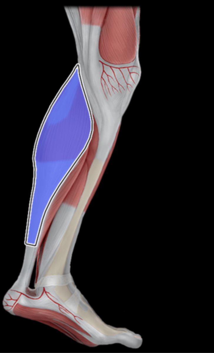 <p>What Muscle Is Highlighted?</p>