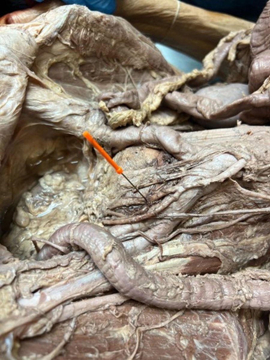 <p>superior rectal artery</p>