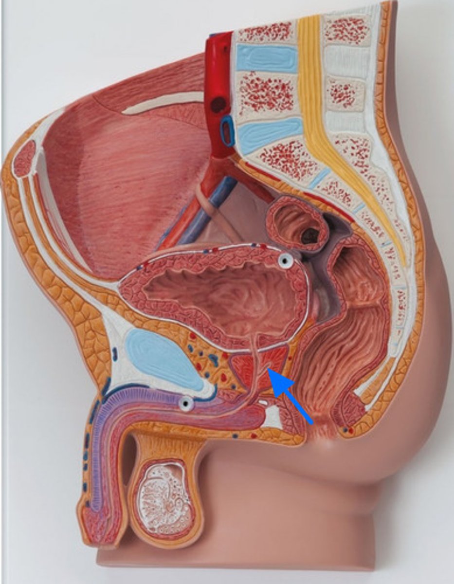 <p>ID Passageway Marked by the Blue Arrow</p>