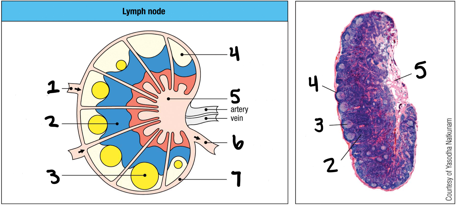 <p>1; where lymph and other cells enter the lymph node</p>