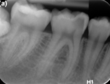 <p>D3</p>