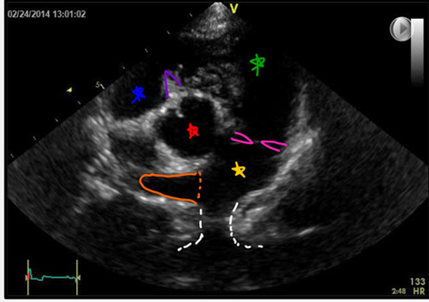 <p>ID parts of heart</p>