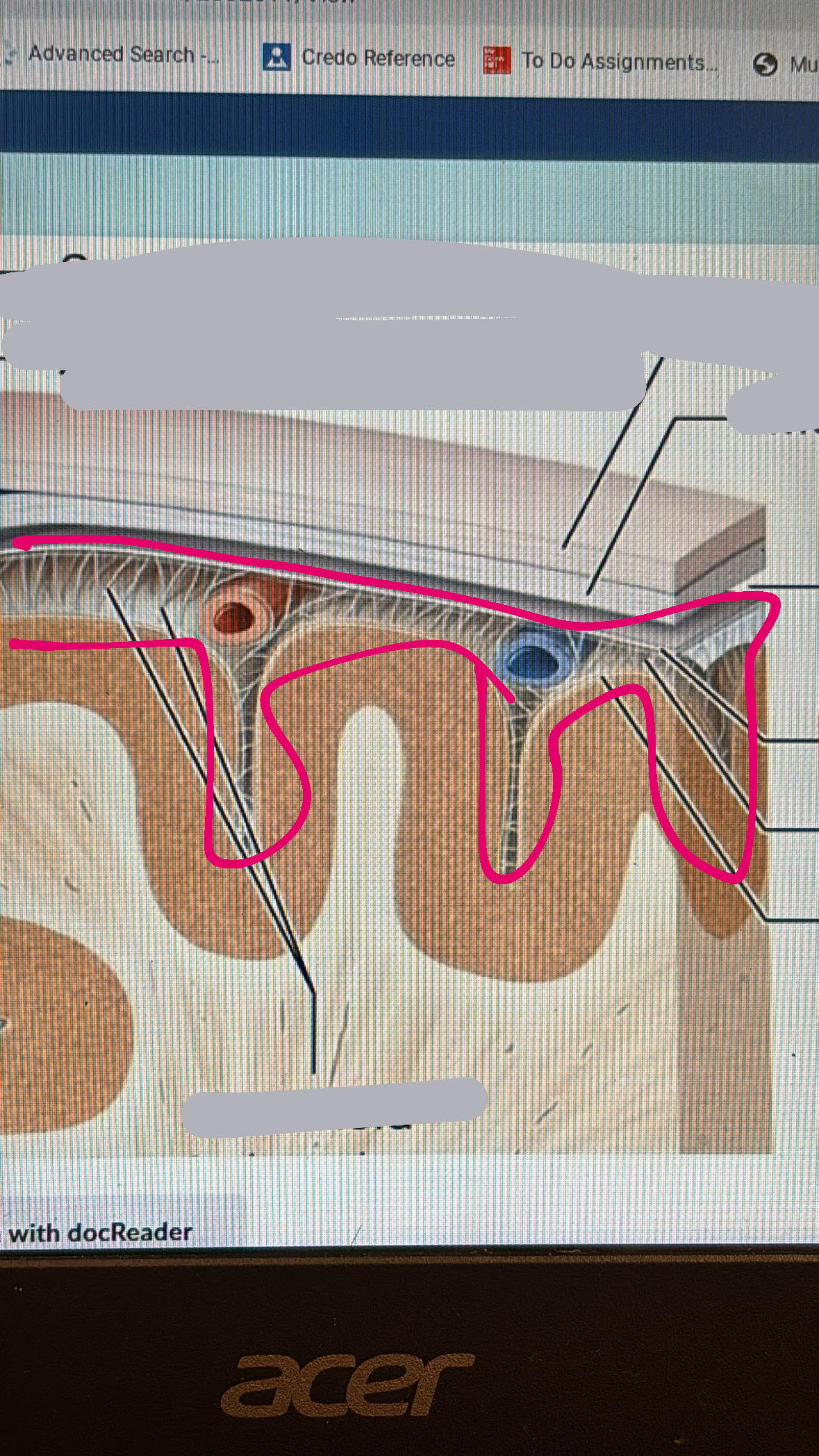<p>space with hair like things below the arachnoid mater but above the pia mater</p>