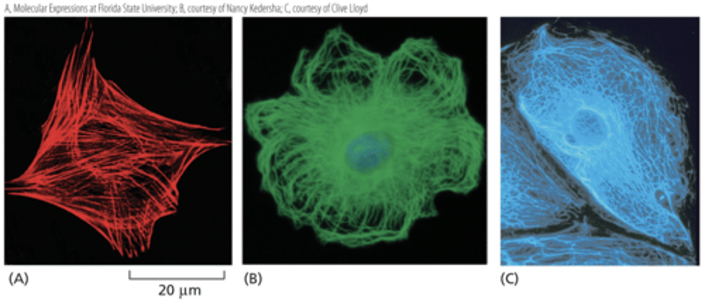 <p>(A)actin filaments,</p><p>(B) microtubules, and</p><p>(C) intermediate filaments.</p>