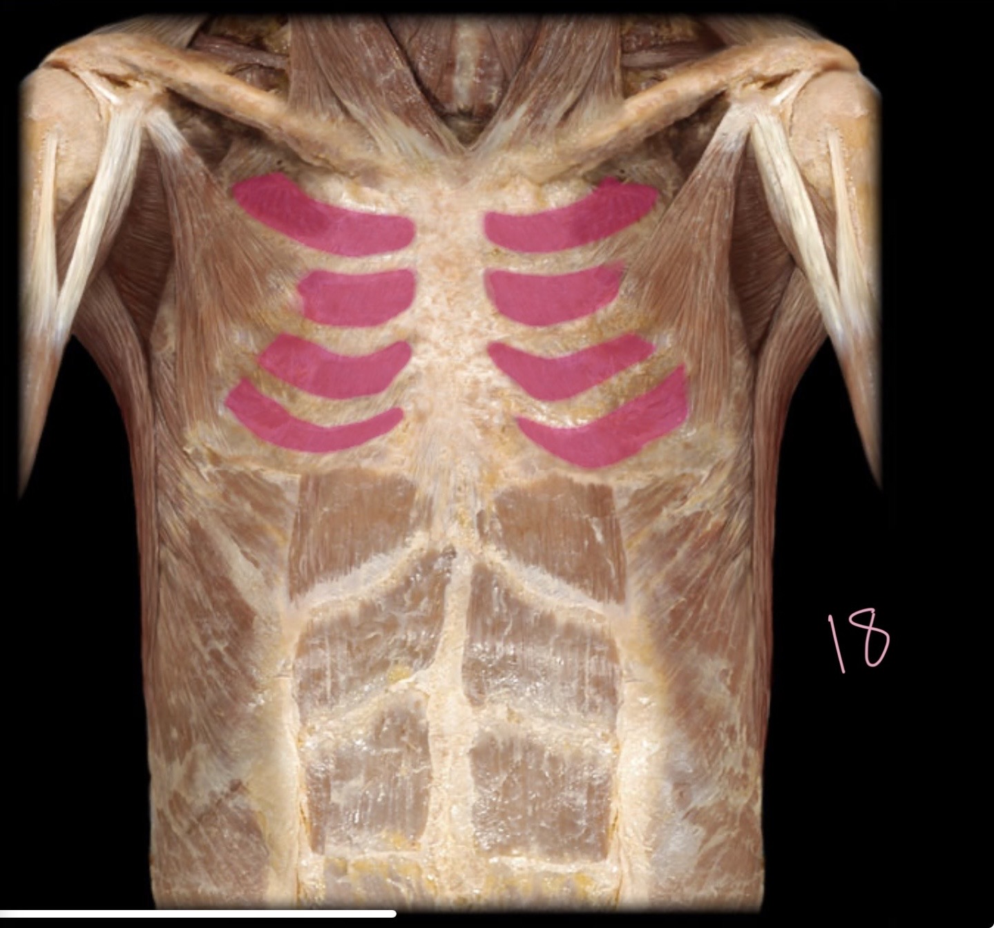 <p>External intercostal</p>