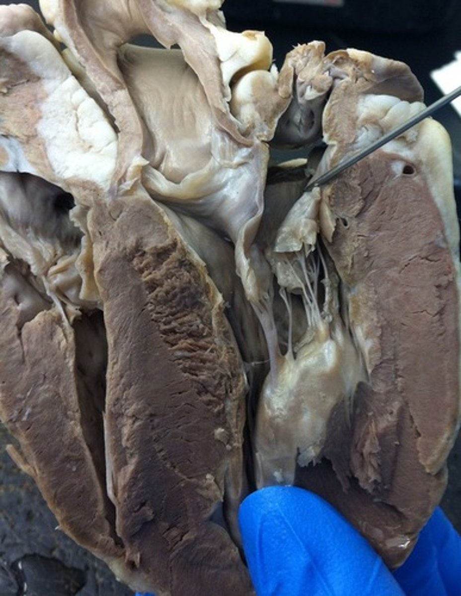 <p>Identify this space within the auricle</p>