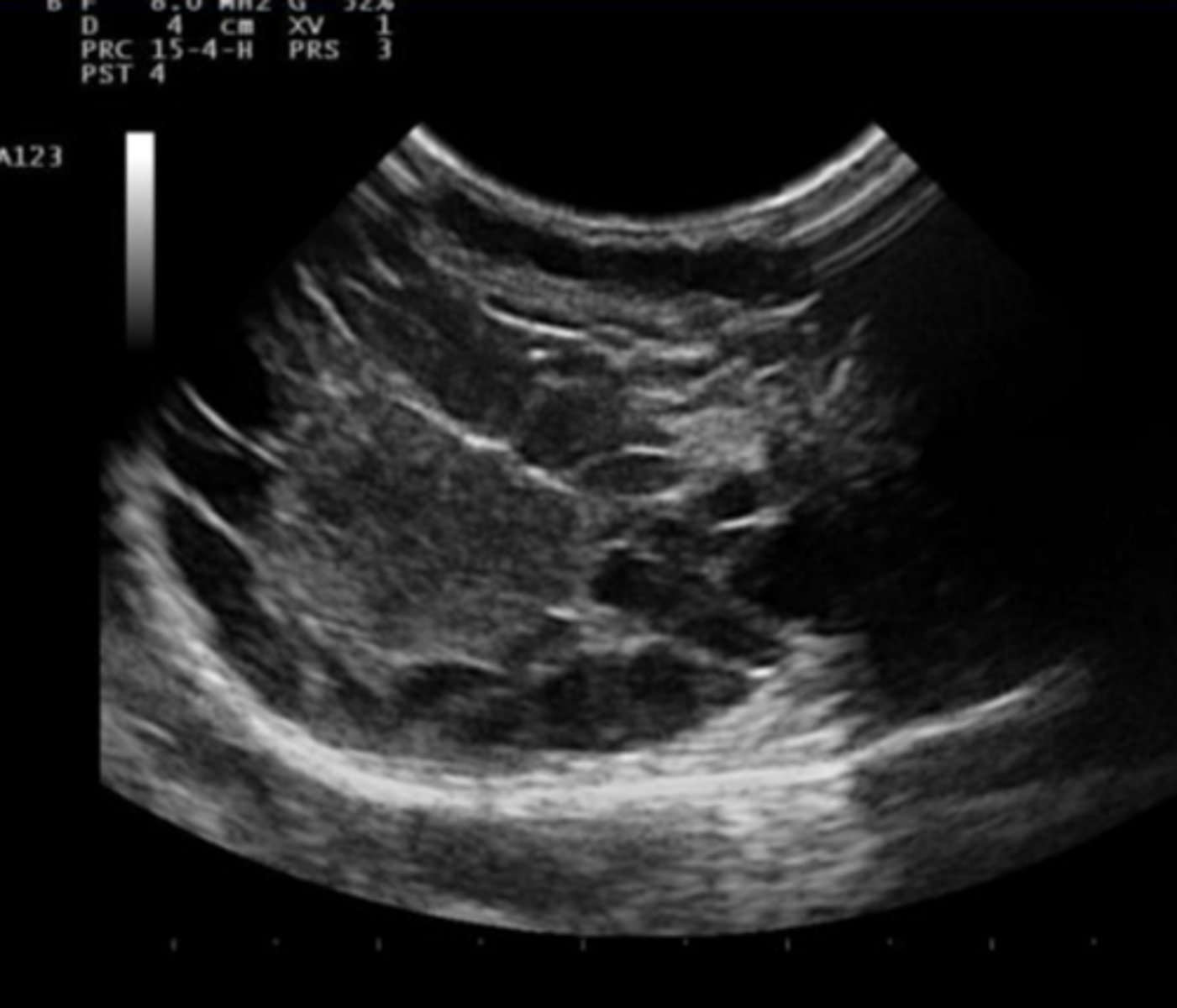 term image