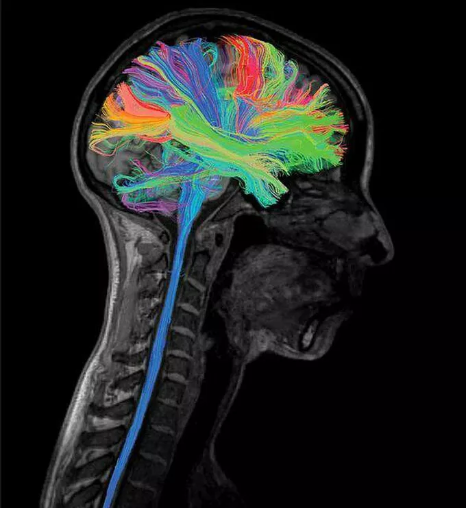 <p>What method of studying the brain is this? </p>