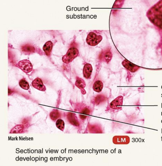 <p>Embryonic Connective Tissue: Mesenchyme</p>