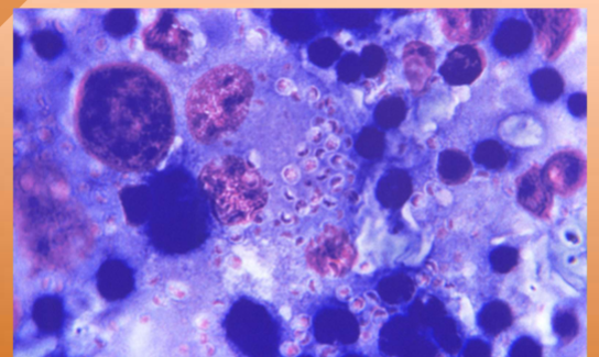 <p><span style="color: rgb(250, 250, 250);"><span>Fever, lethargy, weight loss, diarrhea, loss of appetite, coughing and labored or rapid breathing, eye infections, such as chorioretinitis or retinal detachment, pain or lameness in the joints</span></span></p>