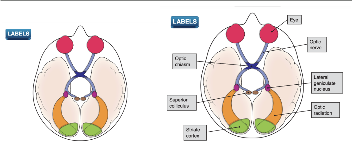 <p><span style="background-color: transparent; font-family: &quot;Times New Roman&quot;, serif;"><span>Optic chiasm: Some of axons of neurons whose cell bodies in the nearest to the nose in optic nerve cross e/o at optic chiasm (ex. Left half of each eye sees the right side of the world)&nbsp;</span></span></p><p><span style="background-color: transparent; font-family: &quot;Times New Roman&quot;, serif;"><span>Superior colliculus: Most axons in optic nerve connect to LGN, some synapse w here.&nbsp;</span></span></p><ul><li><p><span style="background-color: transparent; font-family: &quot;Times New Roman&quot;, serif;"><span>Eye movements, older than LGN evolutionarily</span></span><br></p></li></ul><p><span style="background-color: transparent; font-family: &quot;Times New Roman&quot;, serif;"><span>Lateral geniculate nucleus (LGN)</span></span></p><ul><li><p><span style="background-color: transparent; font-family: &quot;Times New Roman&quot;, serif;"><span>Primary relay station for info flowing from eye to brain. Axons leaving the retina via optic nerve, then synapse w new neurons</span></span></p></li><li><p><span style="background-color: transparent; font-family: &quot;Times New Roman&quot;, serif;"><span>Contains 6 layers of neurons</span></span></p></li></ul><p><span style="background-color: transparent; font-family: &quot;Times New Roman&quot;, serif;"><span>Optic radiation</span></span></p><p><span style="background-color: transparent; font-family: &quot;Times New Roman&quot;, serif;"><span>Axons from cells that synapse w optic nerve fibers in LGN → optic radiations to primary visual cortex (Contralateral: Radiations on left side of brain are carrying info from right side of the world)</span></span></p><p><span style="background-color: transparent; font-family: &quot;Times New Roman&quot;, serif;"><span>Striate cortex (primary visual cortex): First place in cerebral cortex where visual info is received and processed (40% of cortex is directly involved in processing visual info)</span></span></p>