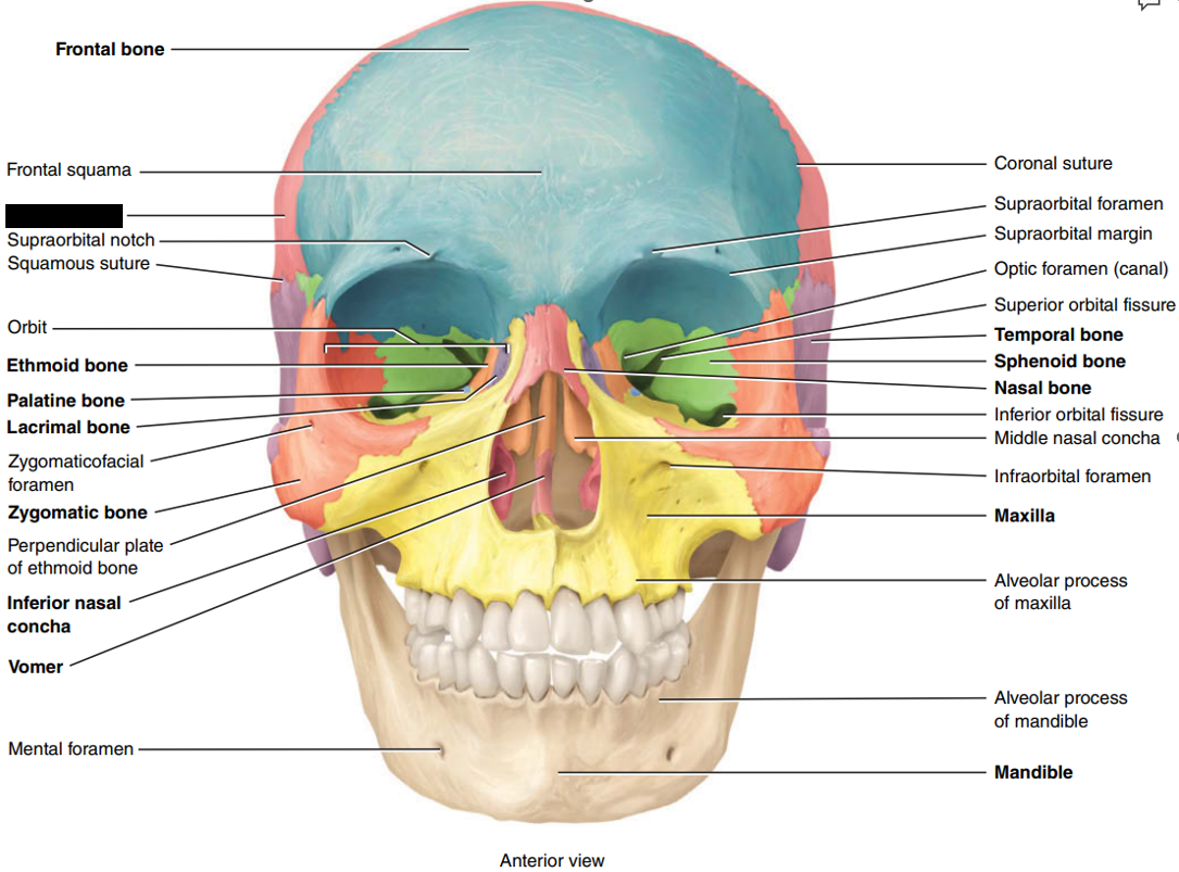 <p>State and identify which part of the cranial bone is being censored.</p>