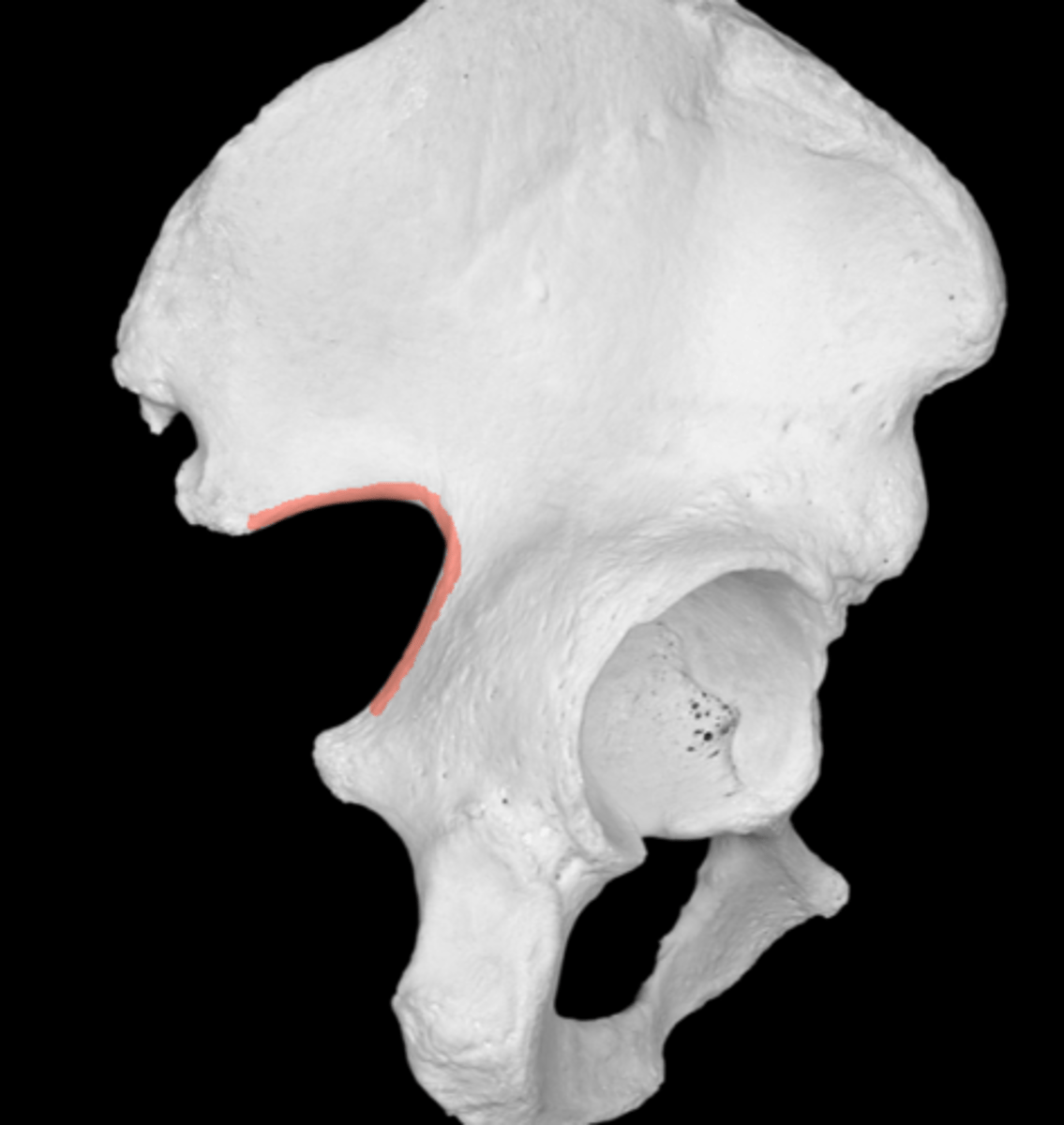 <p>between PIIS and ischial spine</p><p>major nerves and vessels from pelvic cavity into posterior region of lower limb</p>