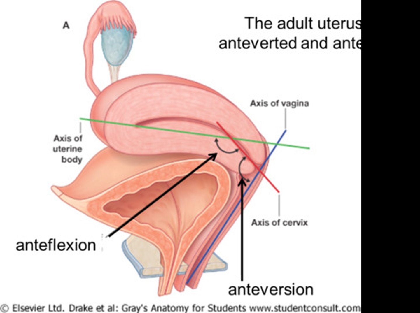 <p>tilted forward uterus (only cervix is anchored)</p>