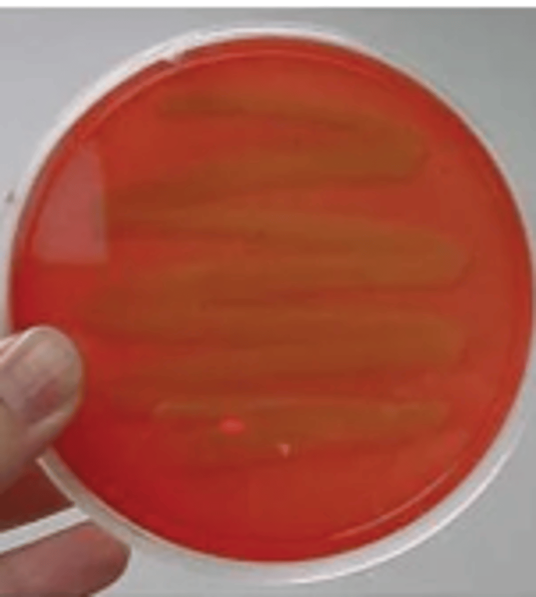 <p>no change - only see swab line</p>