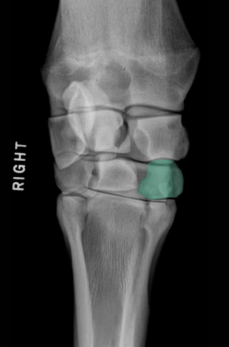 <p>What bone is highlighted?</p>