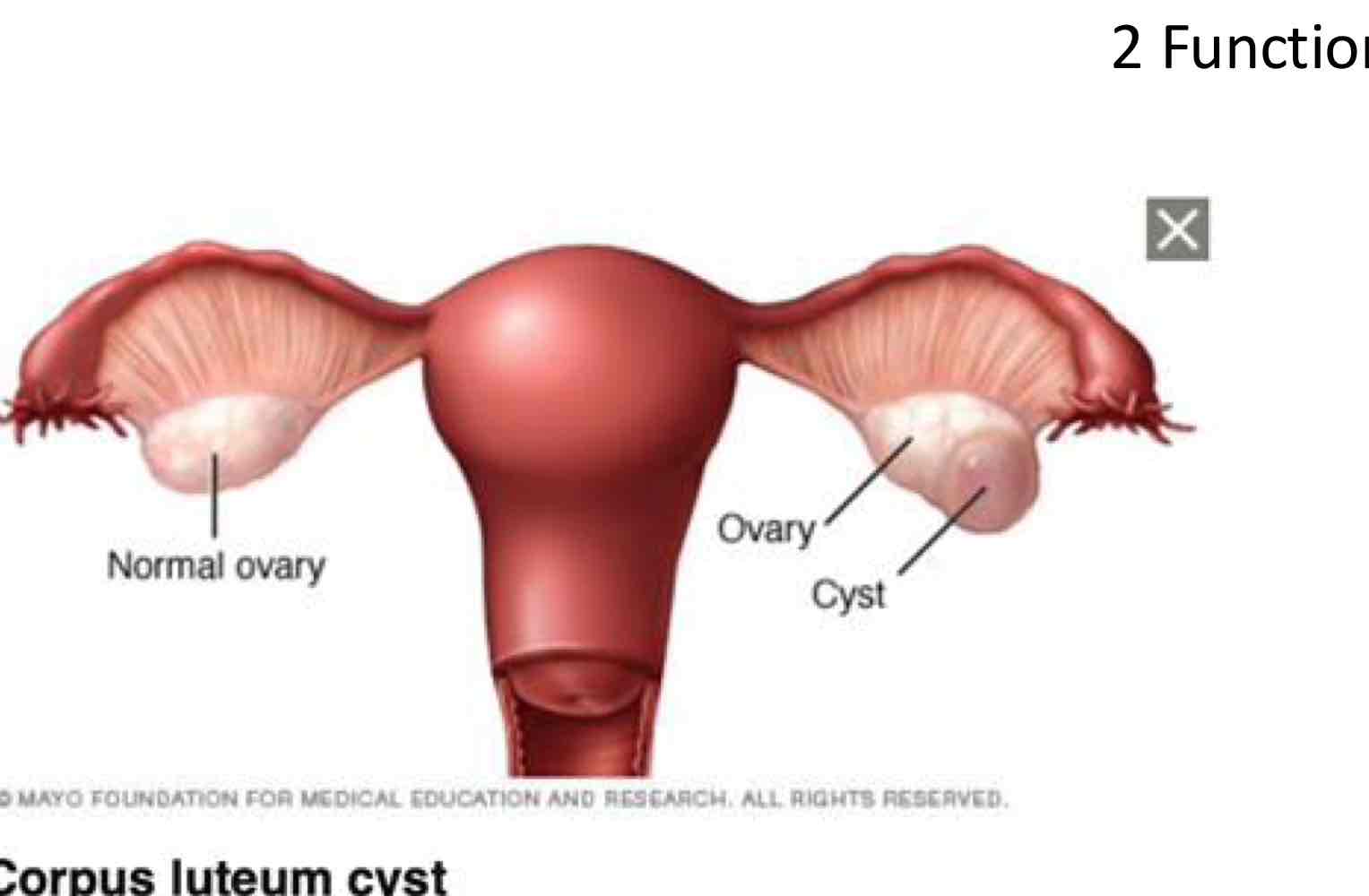 <ul><li><p>Follicles </p><ul><li><p>Cause the egg’s escape opening to seal off. </p></li></ul></li><li><p>Fluid accumulates inside the <strong>follicle</strong></p><ul><li><p>a corpus luteum cyst develops.</p></li></ul></li></ul><p></p>