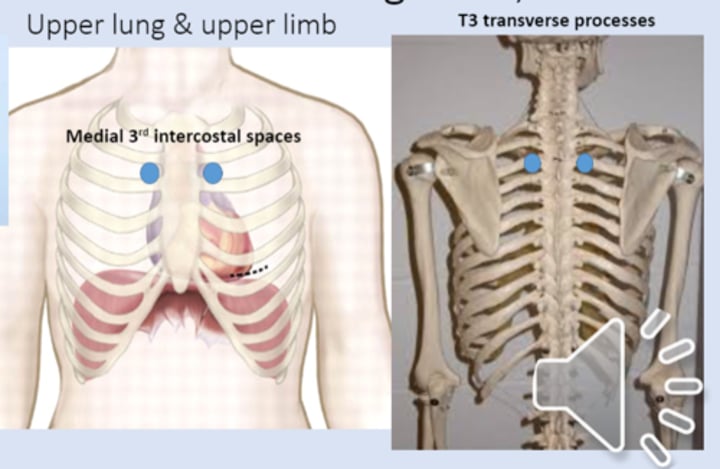 <p>anterior point: medial 3rd intercostal spaces<br>posterior point: T3 transverse processes</p>