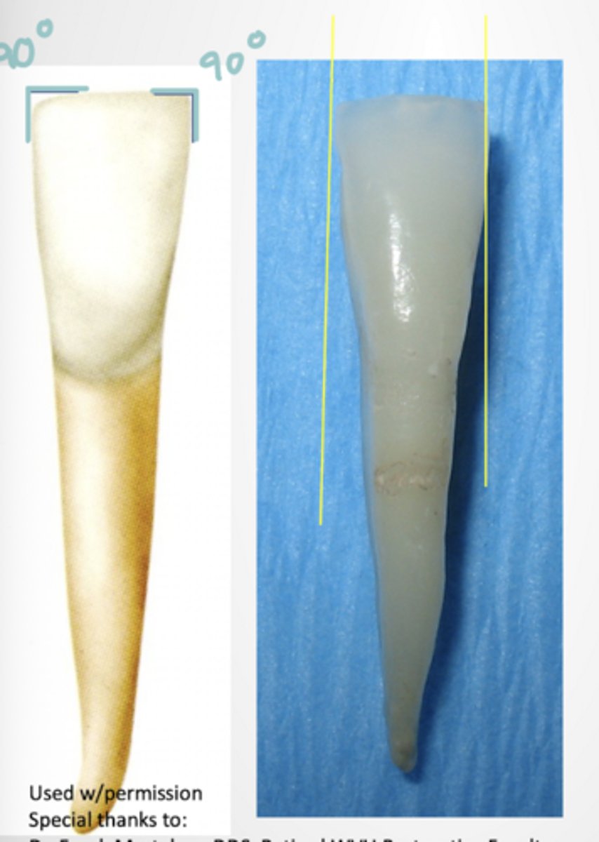 <p>- M, I, and D 90 degree angle</p><p>- M and D HOC in incisal third at same level</p><p>- Developmental depressions faint or absent</p>